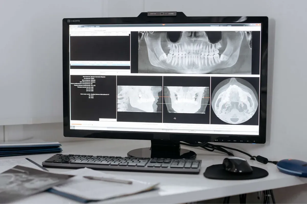 Imed Ortopan Analiza Celjusti Na Monitoru