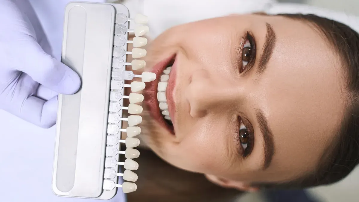 Pacijentica s nijanserom za zubne ljuskice