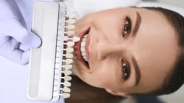 Pacijentica s nijanserom za zubne ljuskice